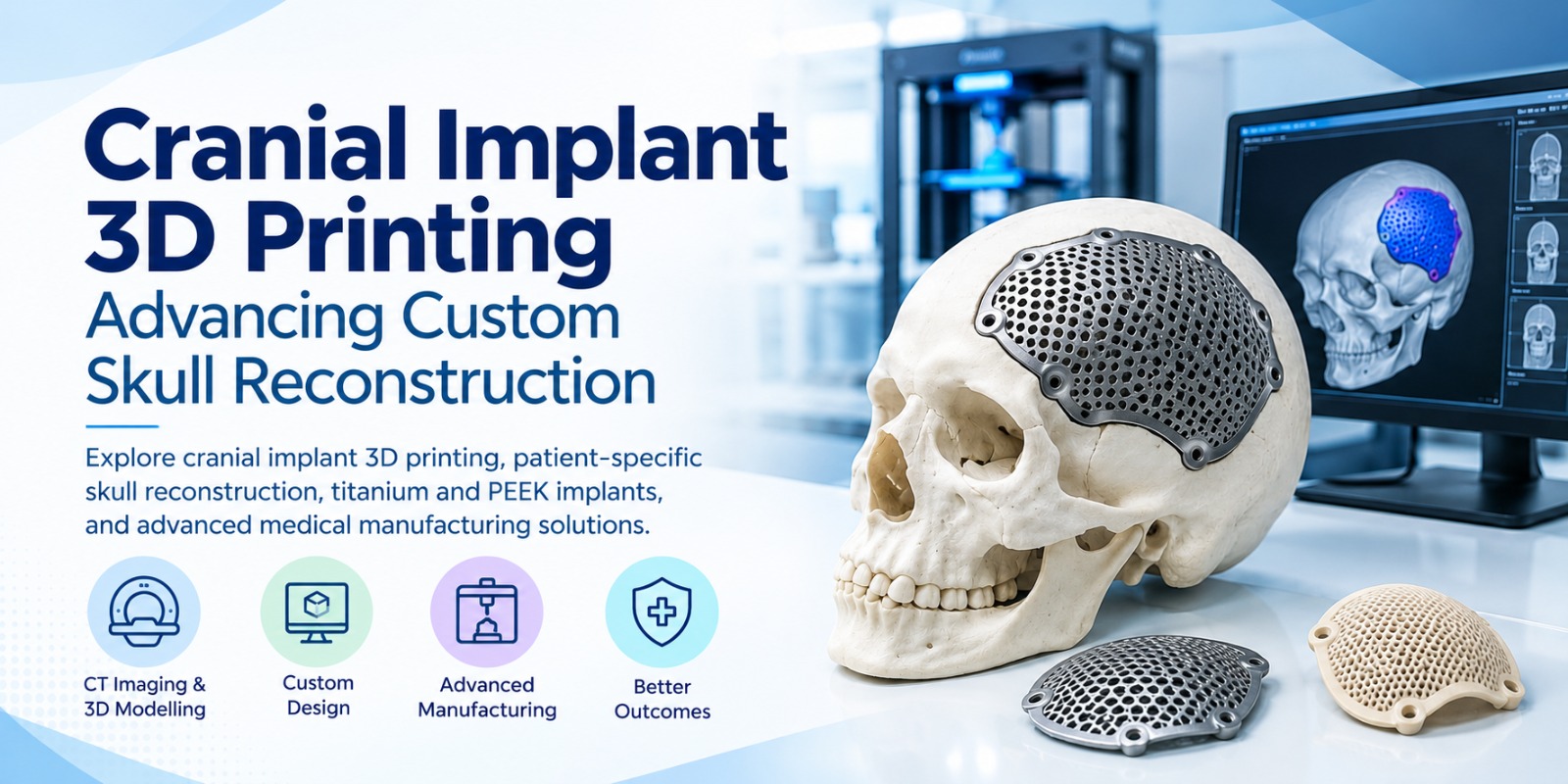 Cranial Implant 3D Printing for Custom Skull Reconstruction